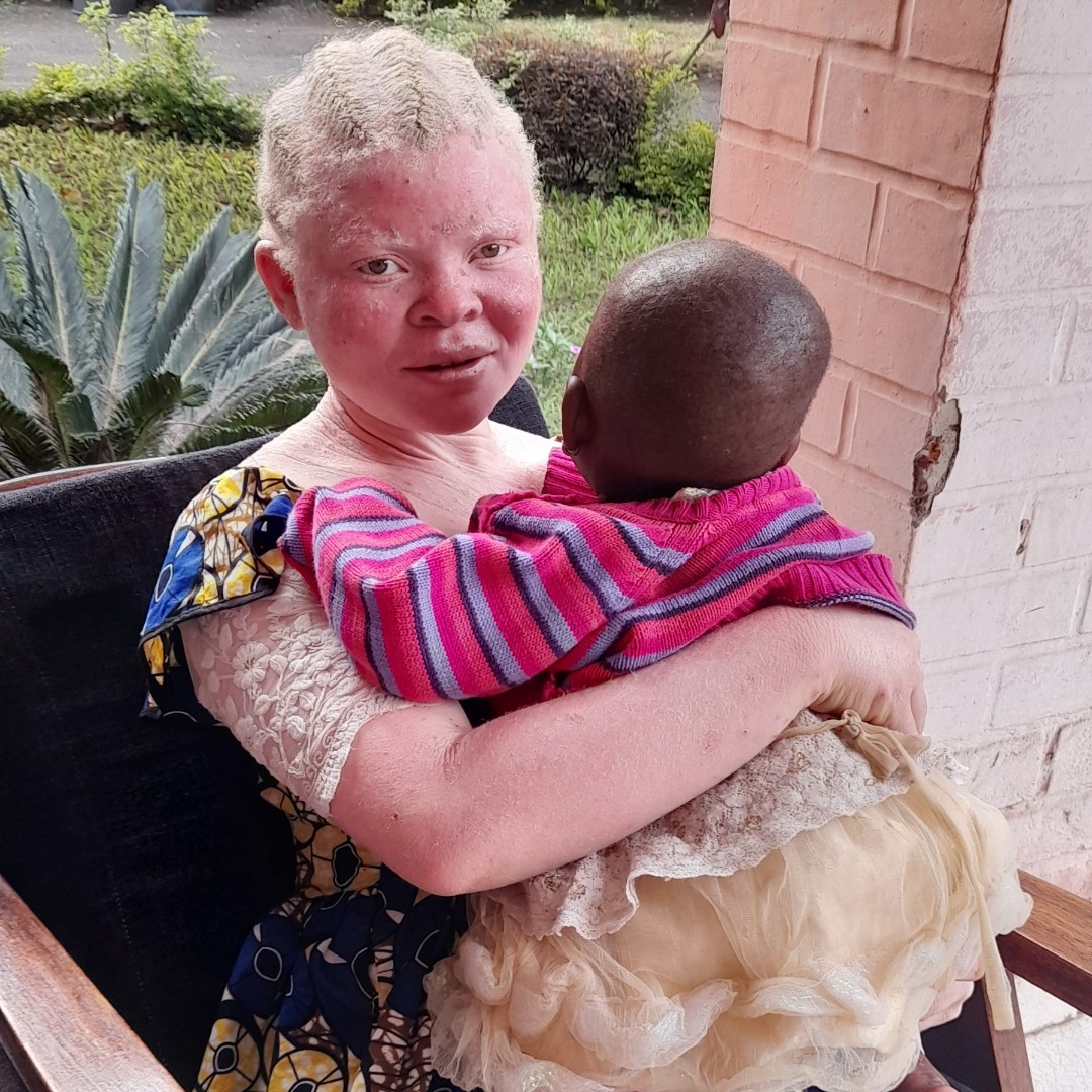 Nyota: superviviente de violencia sexual y defensora de las personas albinas en RDC